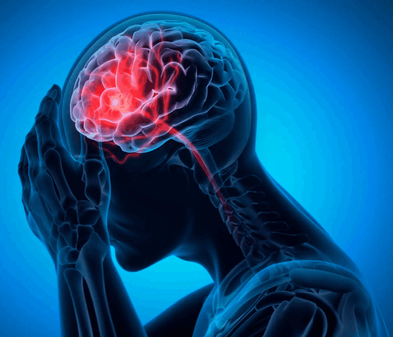 3D illustration of a brain with highlighted blood vessels and pain in the head.